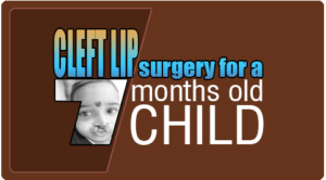 Cleft lip surgery for baby in India