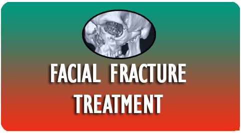 Facial Fracture Treatment in India