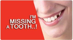 Removable Partial Denture Treatment