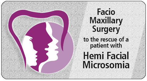 facio maxillary surgery in India