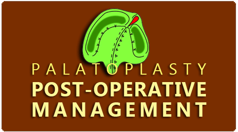 post op preparations Palatoplasty