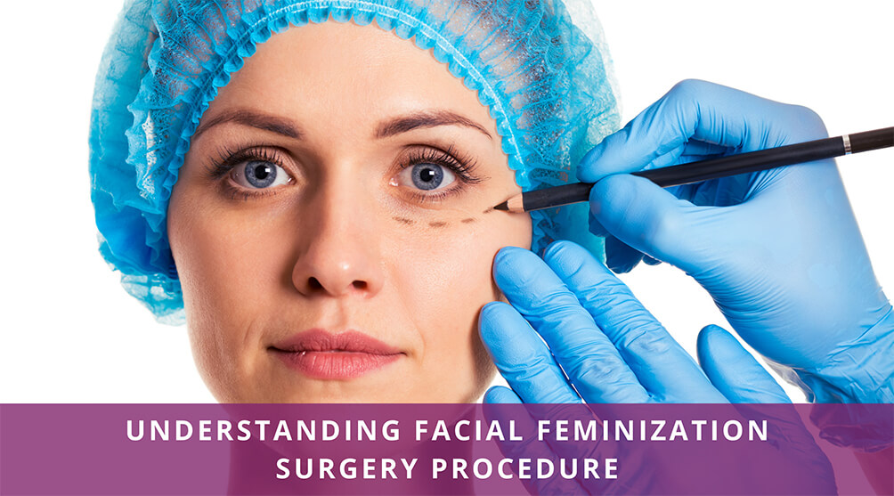 Facial Feminization Surgery Procedures