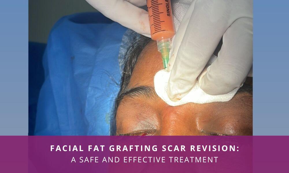 facial fat grafting scar revision india